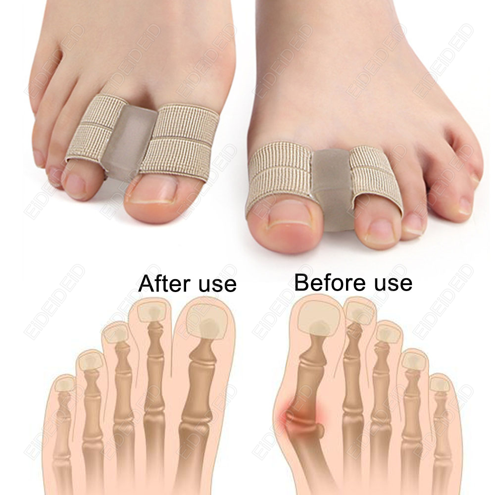 Corrector de juanete para pies - Women'S Shoes For Bunions reseña y precio